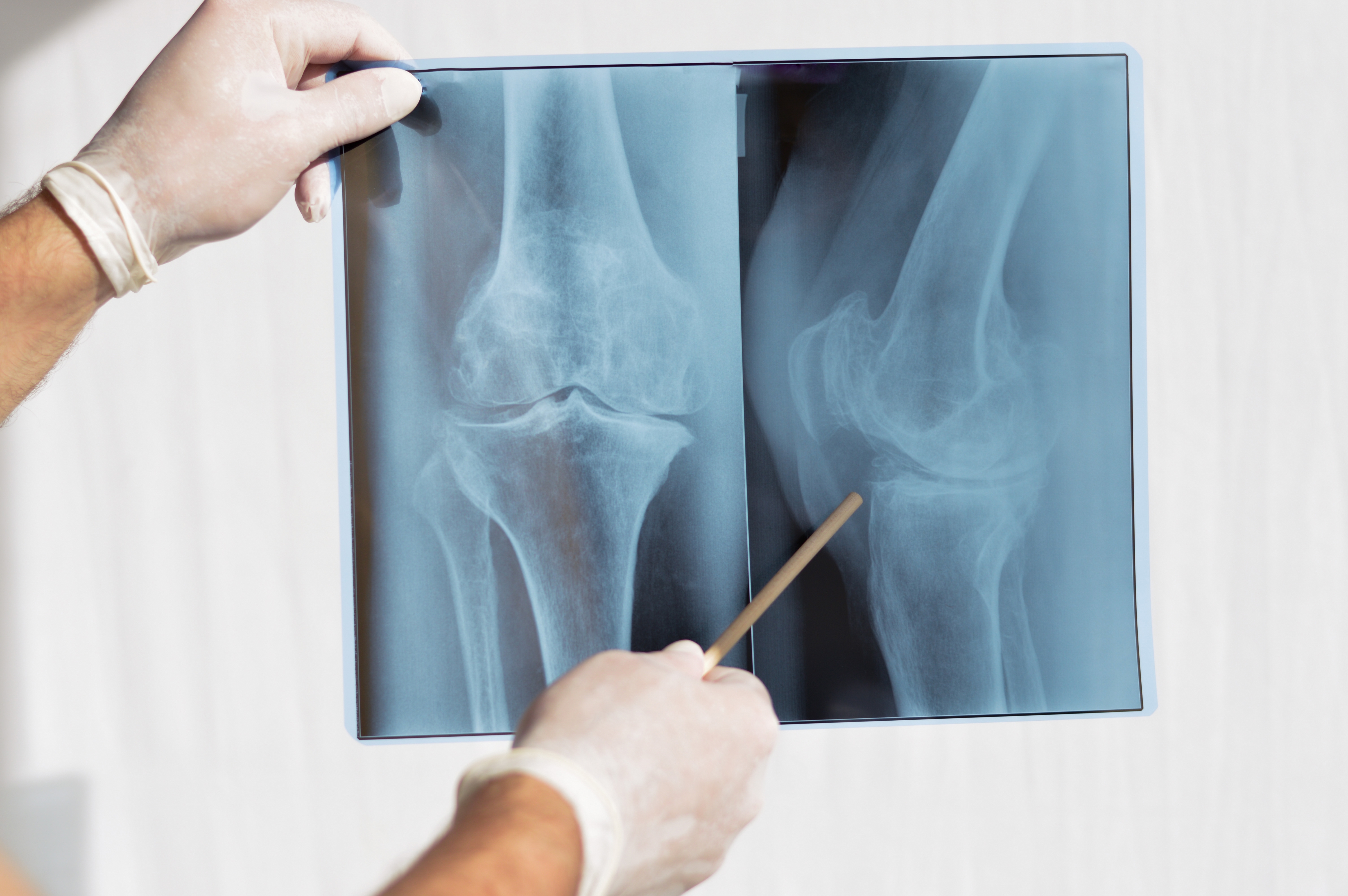 Physician reviewing joint X-ray images while assessing a patient's symptoms